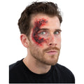 Burn Skin Kit