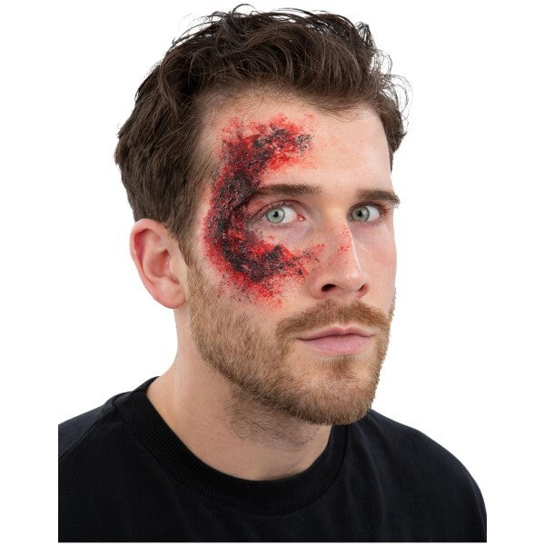Burn Skin Kit