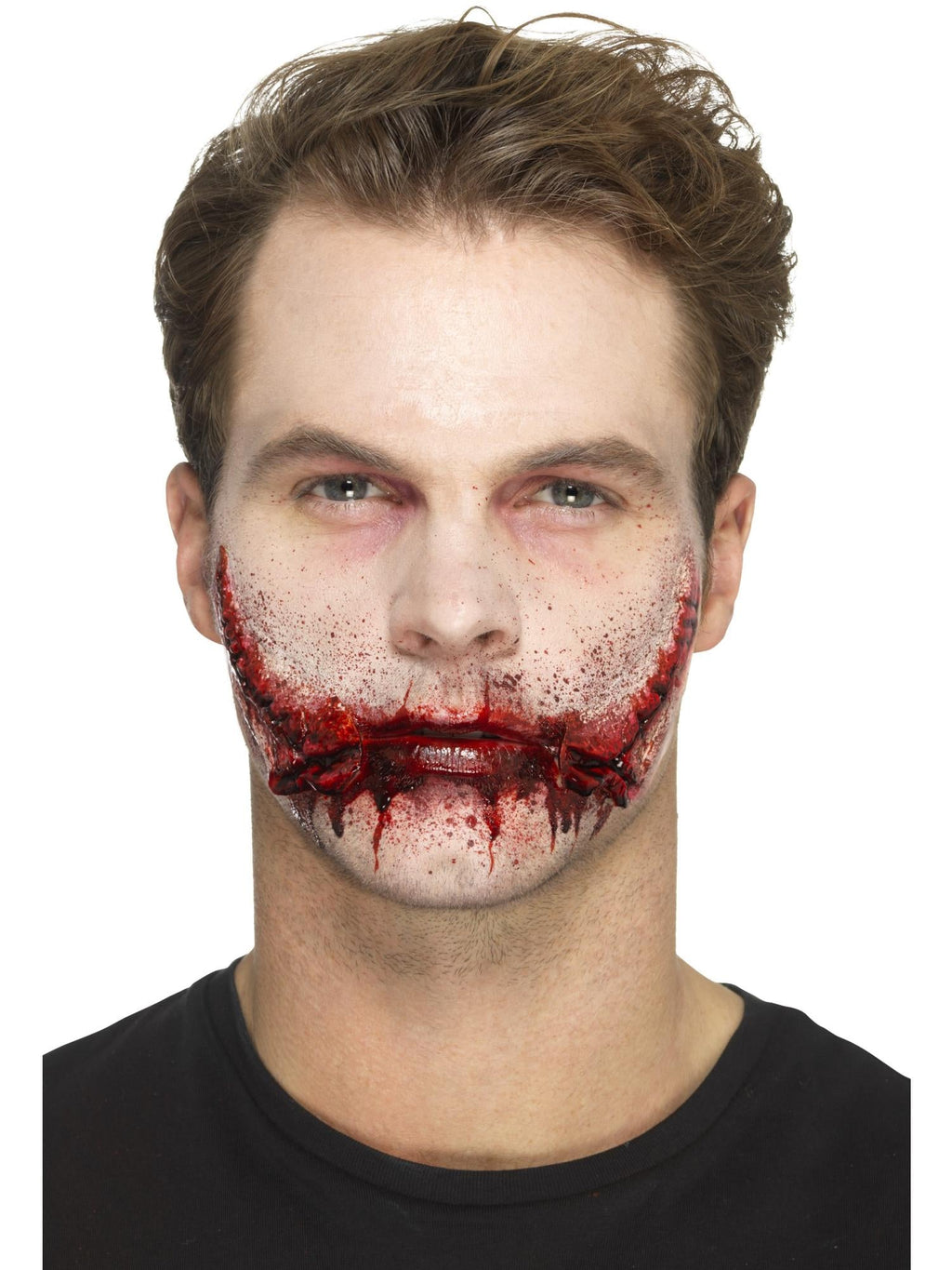 Stitched Smile Prosthetic