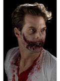 Stitched Smile Prosthetic
