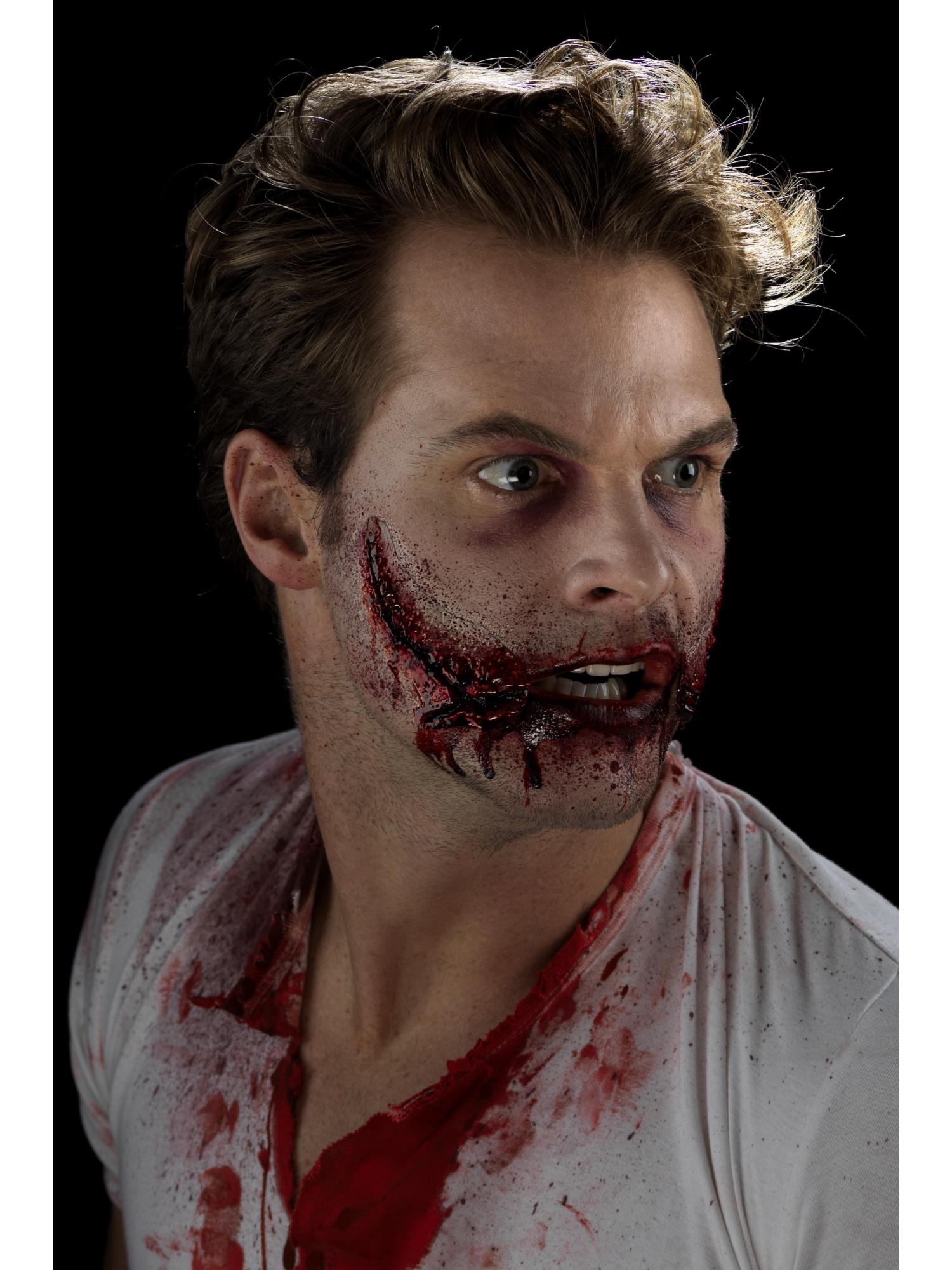 Stitched Smile Prosthetic